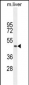 TMEM229A Antibody (Center)